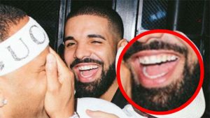 A phot of Drake smiling, then a closeup of his smile