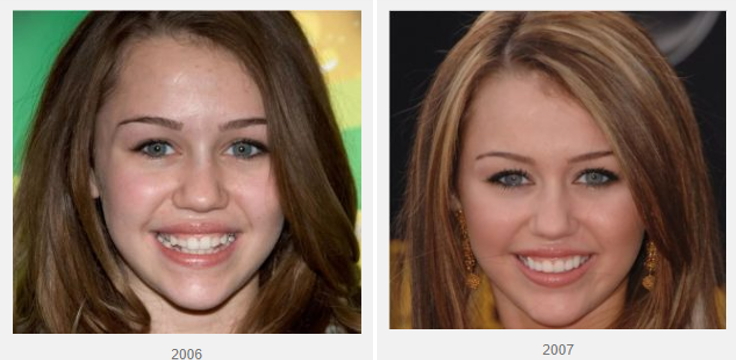 Two images of Miley Cyrus before and after her cosmetic work