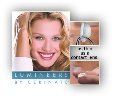 Lumineers advertisement containing a woman smiling, a Lumineer being held up with a dental tool, and one compared with a contact lens. 