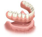 Image of dentures for a bottom arch