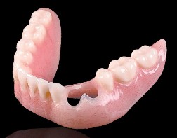 Cu-Sil partial dentures